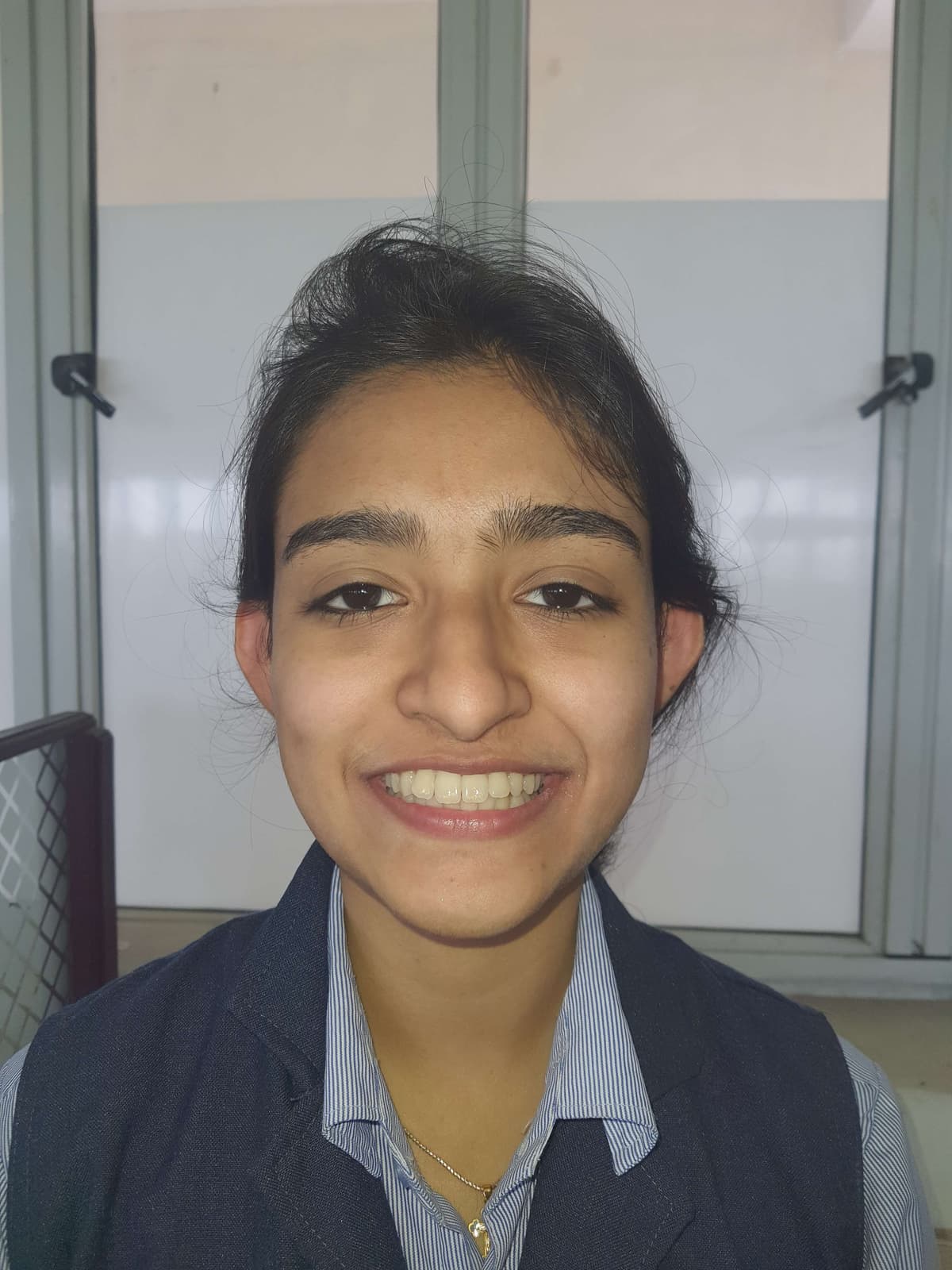 Before Orthodontic braces